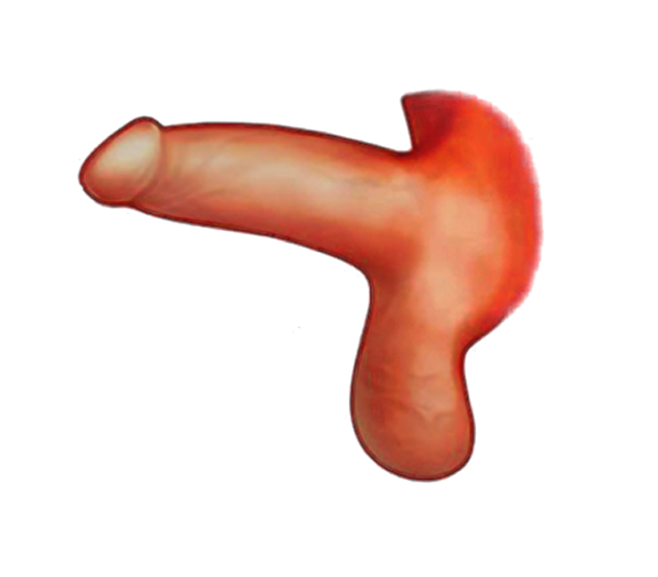 음경갈퀴 수술 후